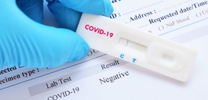 Δειγματοληπτικοί έλεγχοι για Covid- 19 στον Εμπεσό Αιτωλοακαρνανίας την Πέμπτη 22/4/2021 απο 9:30 πμ