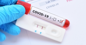 Προληπτικός έλεγχος με Rapid test Covid-19 την Παρασκευή 29 Ιουλίου 2022 στην Βόνιτσα