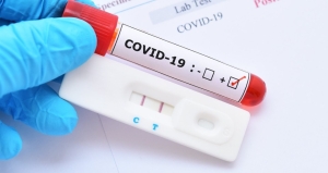 Αιτωλοακαρνανία: Που θα πραγματοποιηθούν την Δευτέρα 17/6/2024 δωρεάν rapid test