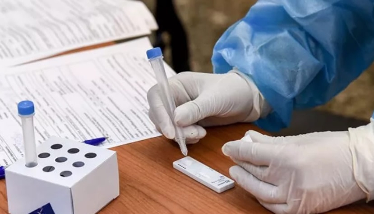 Αιτωλοακαρνανία: Που θα πραγματοποιηθούν την Πέμπτη 2/2/2023 δωρεάν rapid test