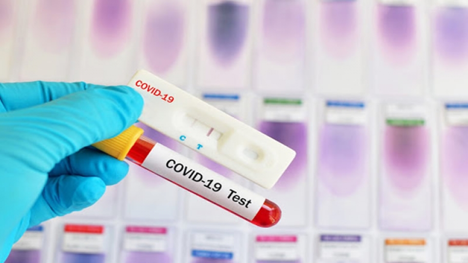 Δωρεάν COVID-19 test την Πεμπτη 11/3/2021 12:00 στο Λουτρό Αμφιλοχίας