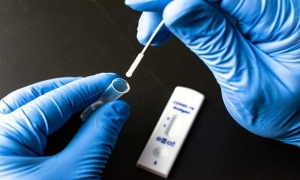 Rapid test στο Αγρίνιο και την Παρασκευή 25/3/2022 από τον ΕΟΔΥ