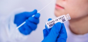 Covid-19: Δωρεάν rapid test σε Μπαμπίνη και Φυτείες (Πεμ 2/9/2021)