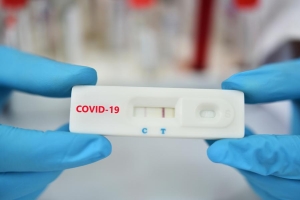 Προληπτικός έλεγχος με Rapid test Covid-19 την Δευτέρα 29 Αυγούστου 2022 σε Πάλαιρο και Μοναστηράκι του Δήμου Ακτίου Βόνιτσας